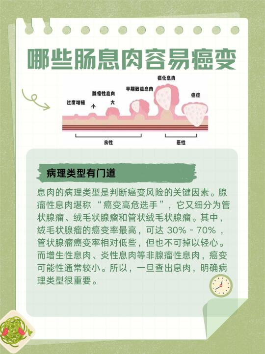 哪些肠息肉容易癌变