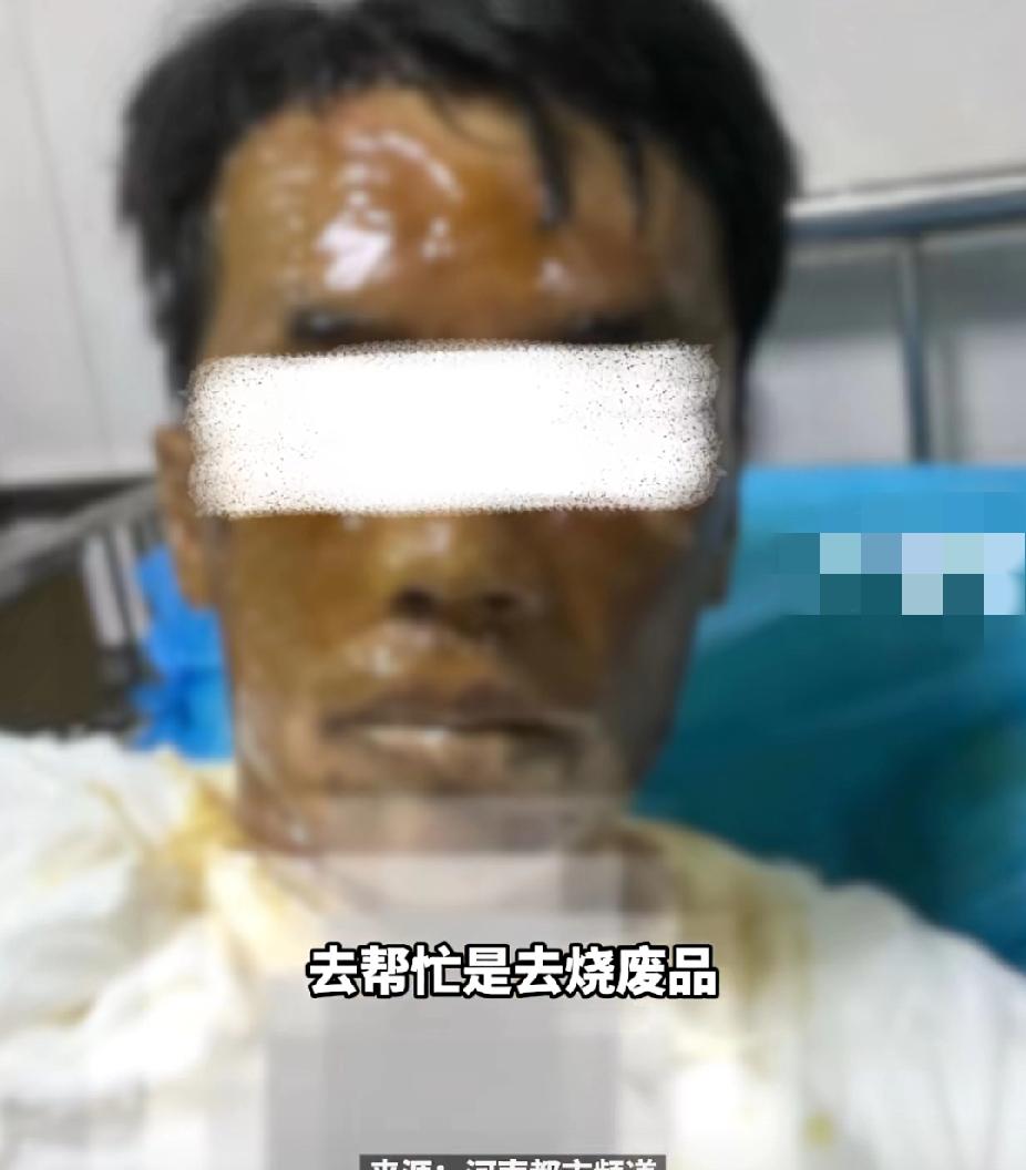 太惨了！11月29日，广东一男子被曝出帮“五保户”邻居烧废品被煤气罐炸得面目全非