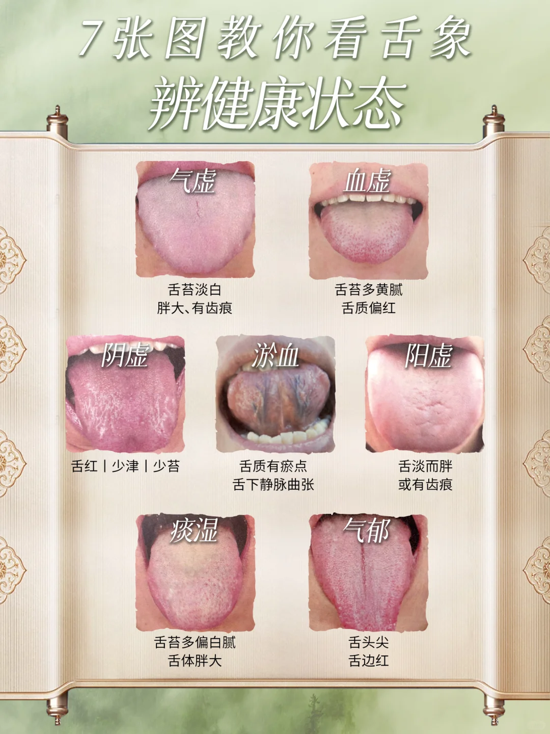 观“舌苔”，辨体质～出现这7种你得注意了‼️