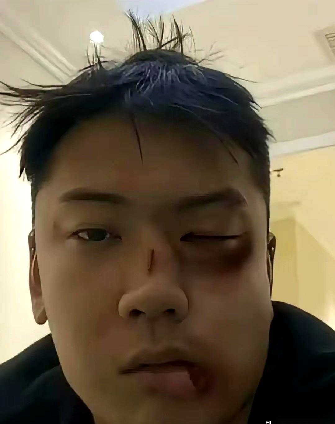 妈耶，真是活久见！昨晚我朋友去看人打麻将，结果被人揍了一顿，你敢信？就因为他多嘴