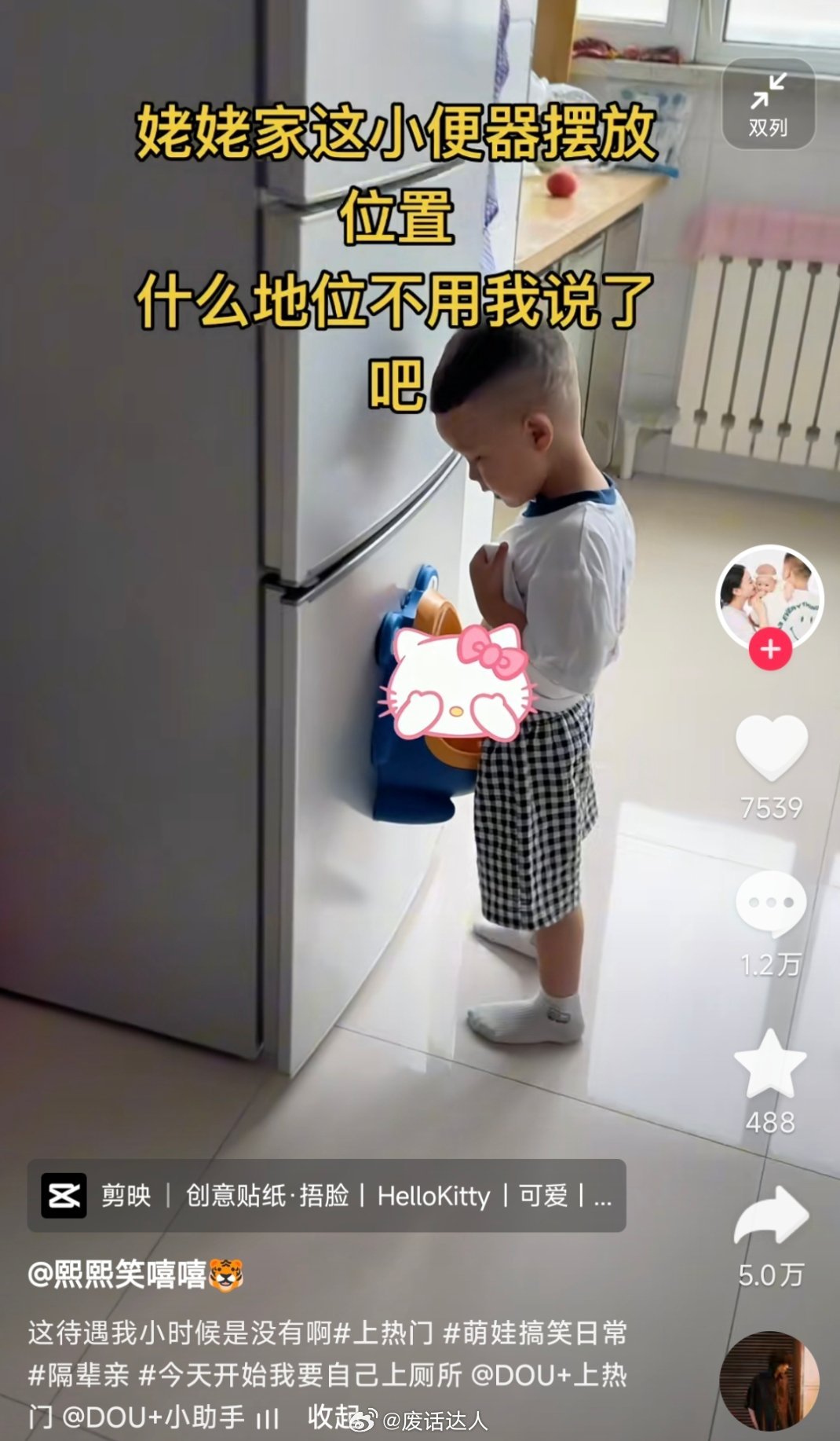 哪里需要整个小便器这么麻烦？耀祖尿的时候直接张嘴接住耀祖的圣水就行啦[可爱] ​
