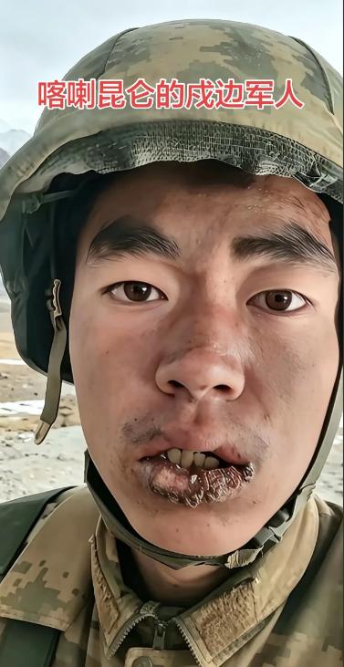 边防战士的嘴唇，隔着屏幕都感觉很疼！他们大多数都是刚刚成年，还是些孩子，正是因为