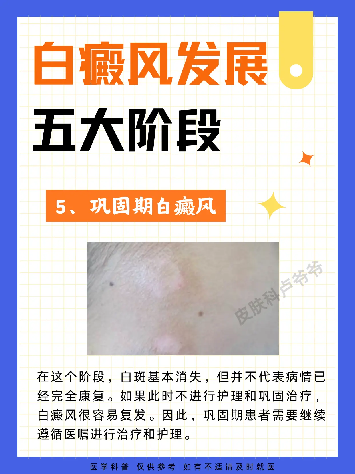 医学科普 白癜风 白斑 硬核健康科普行动  知识分享