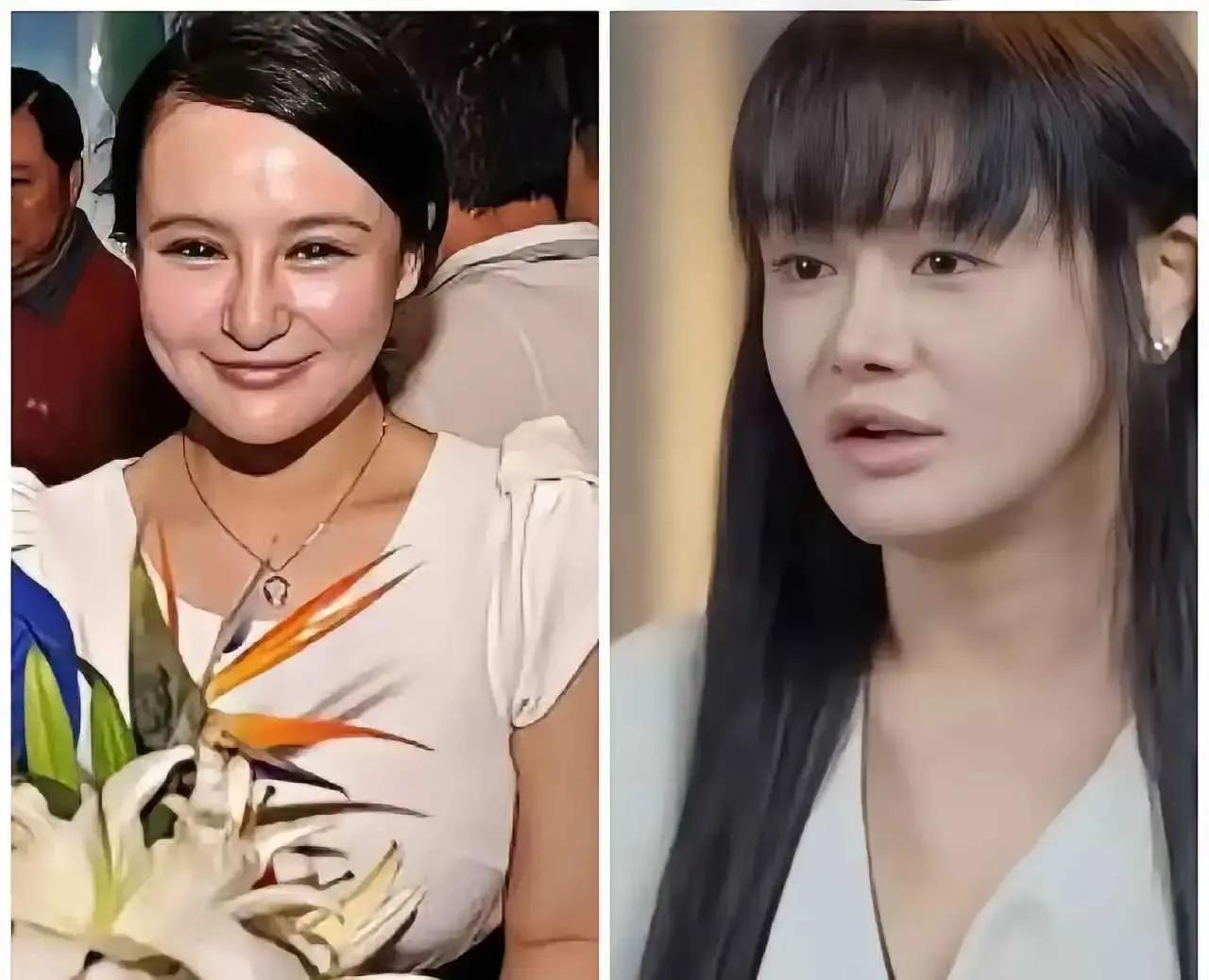 邹市明太听老婆冉莹颖的话，45岁的年纪又要重操旧业，哪怕曾经留下了不可逆的伤痕，
