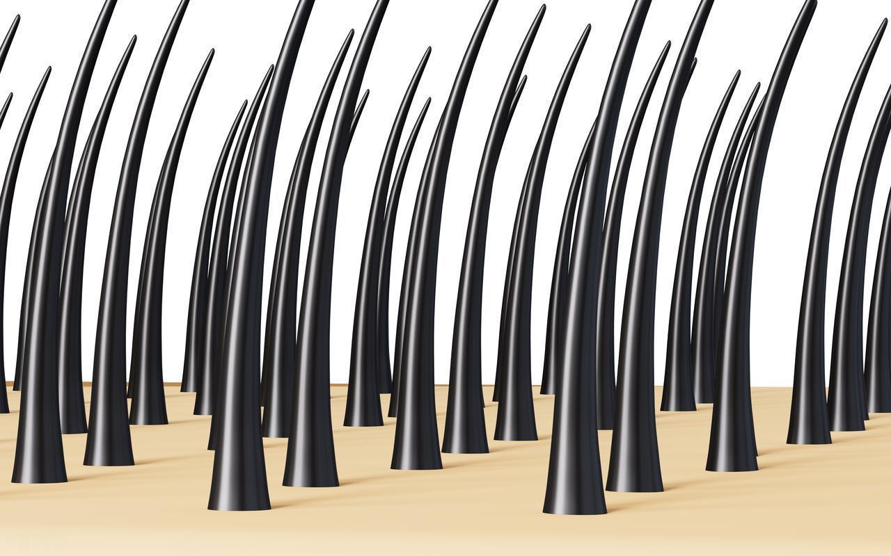 有些女性下身无毛是怎么回事？这4个原因，为了健康，最好了解

有些女性发现自己下