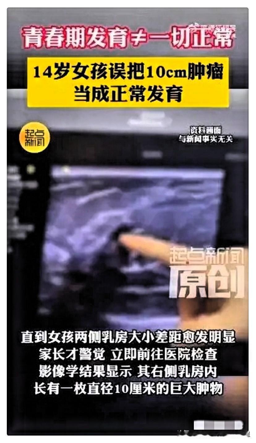 太吓人了！西安14岁初二女生洗澡时摸出右侧乳房鹅蛋大硬块，全家人都当成青春期正常