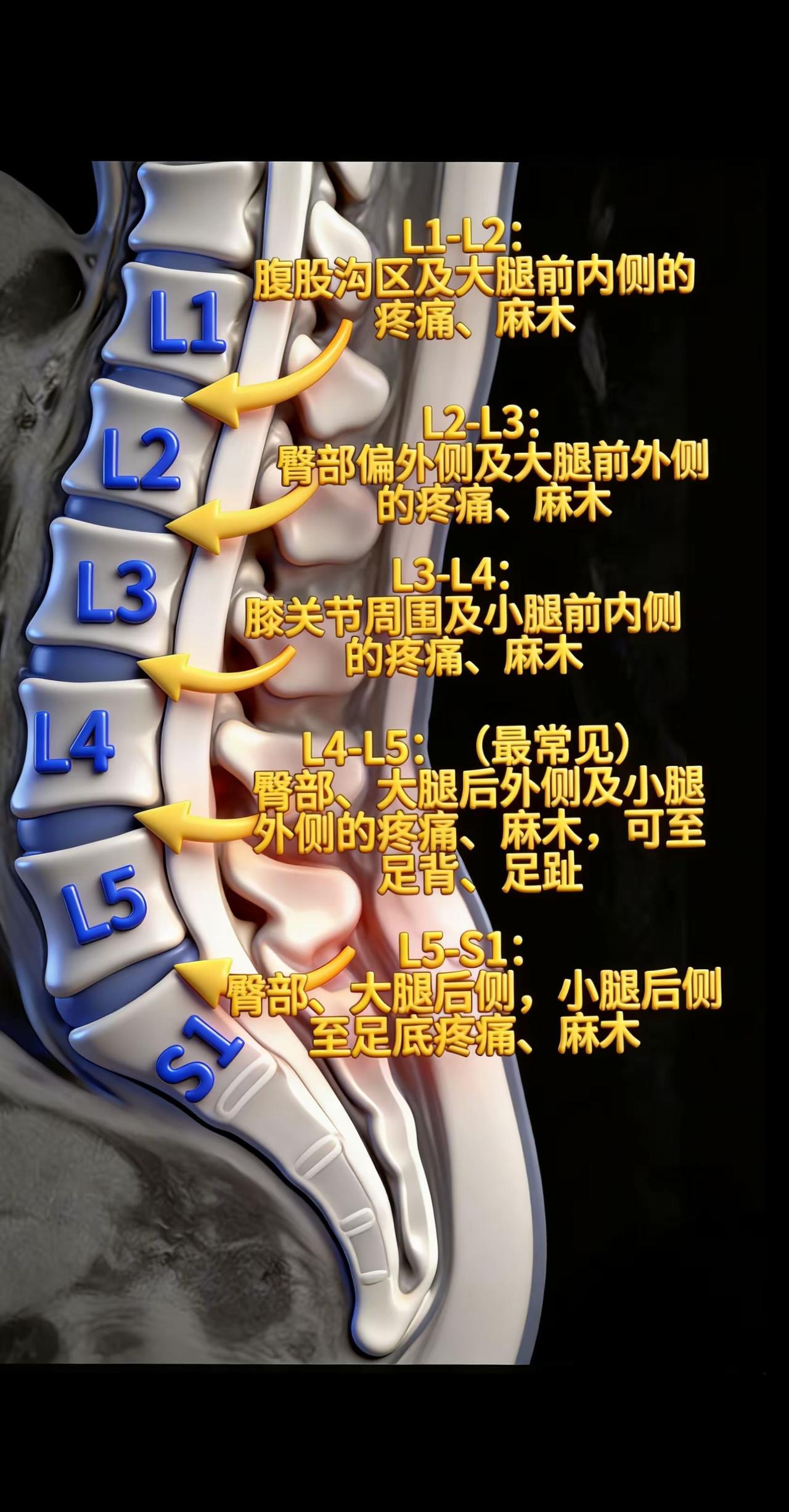 中国有多少人和我一样被肩背疼痛所困扰？不查不知道，一查吓一跳：我并非孤身一人，同