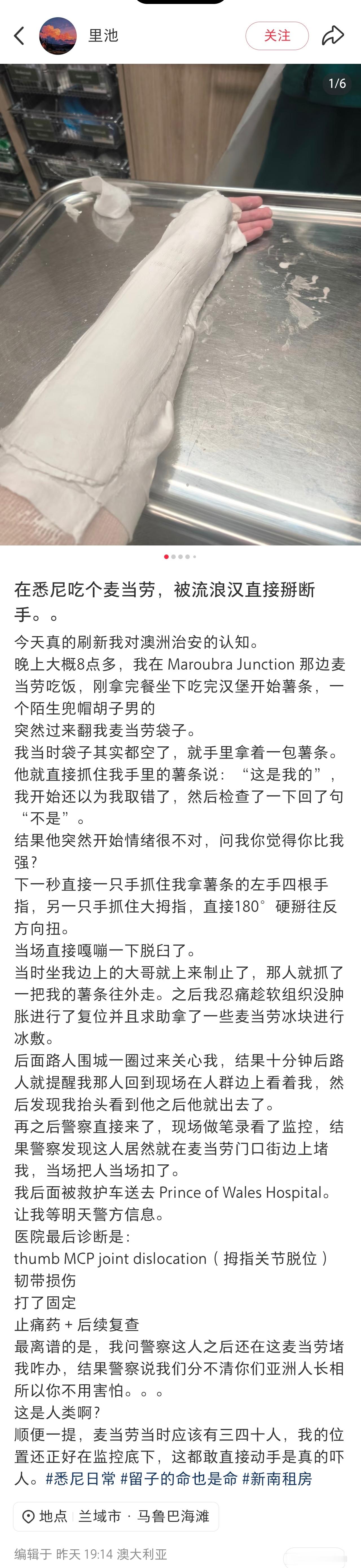 留学生在悉尼麦当劳被流浪汉掰断手留学生在外面遇到危险，真的是防不胜防啊！这还是在