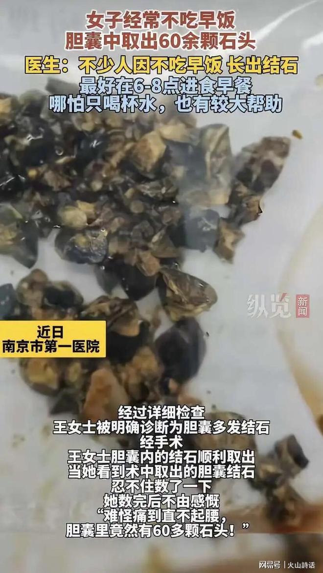 这下长记性了！江苏南京，35岁的王女士因为肚子痛被送进医院，医生从她体内取出60