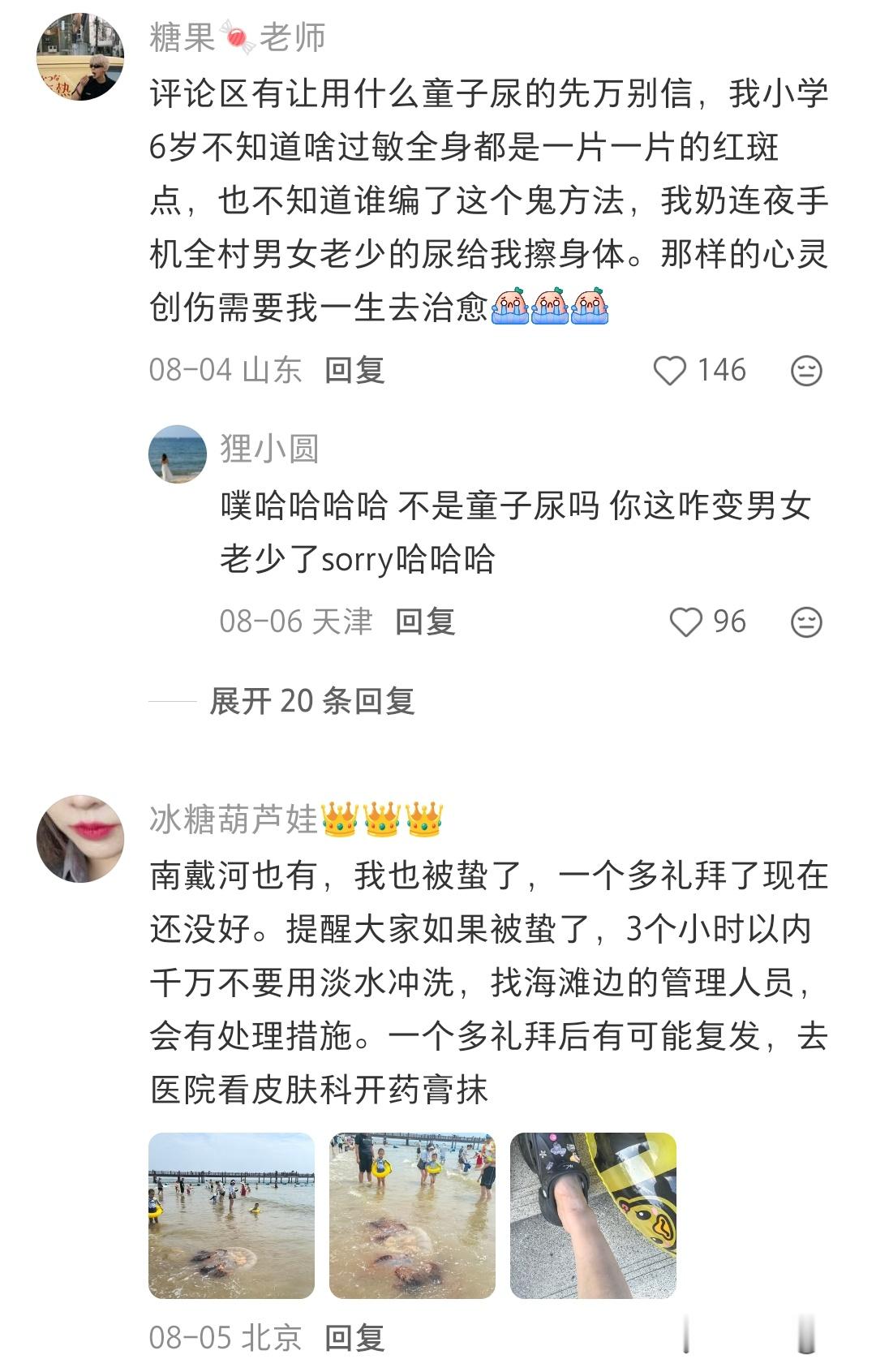 去海边一定要注意海蜇啊，被蜇伤了好严重