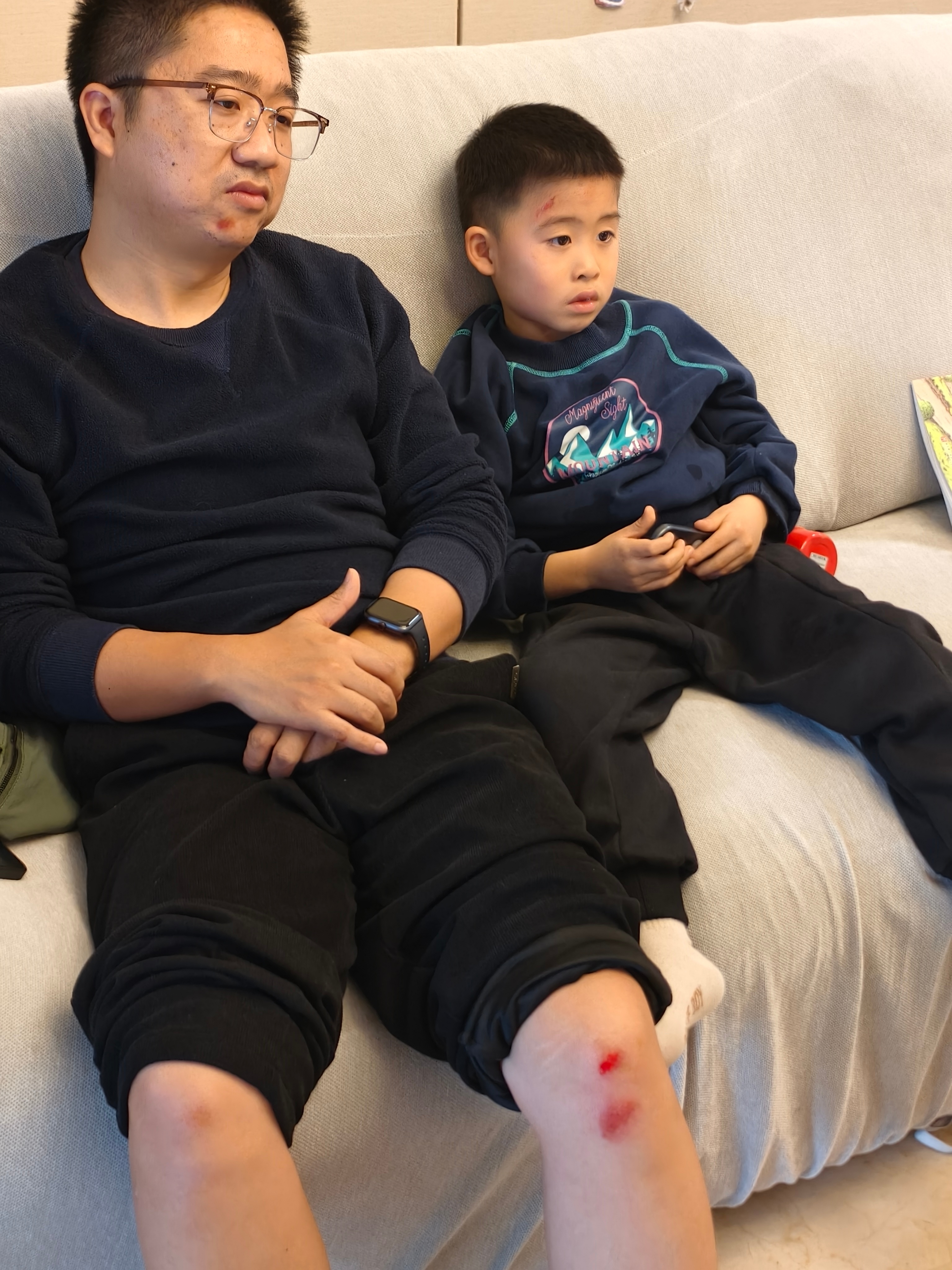 今天带娃学习骑自行车没有带护具的后果…，双双负伤。 