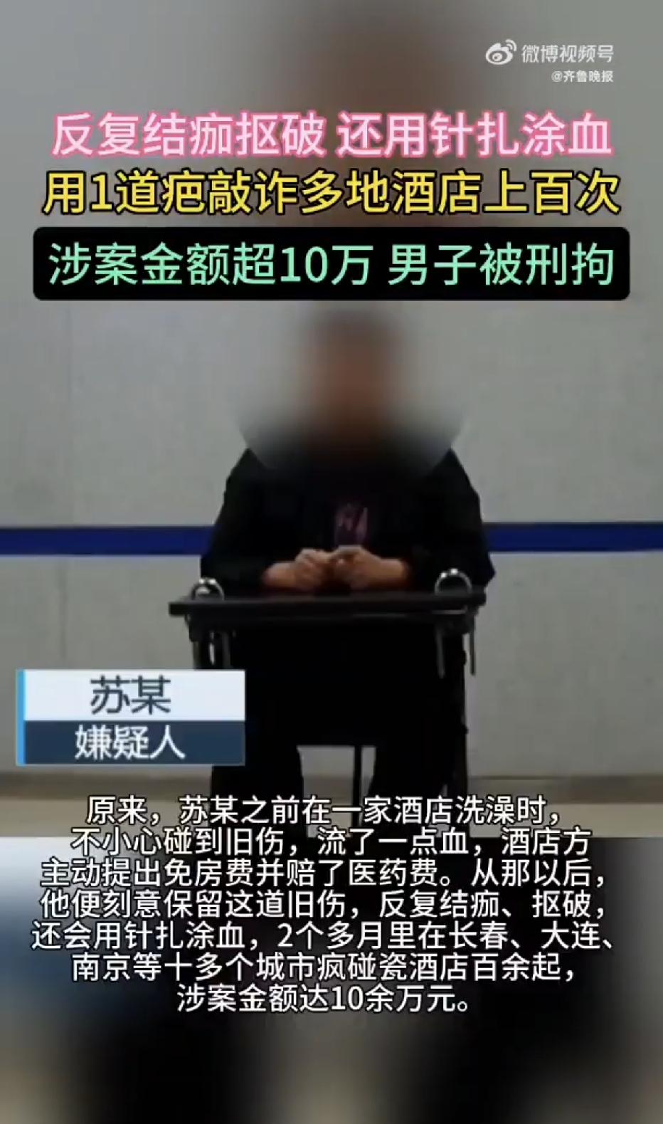 南京，一男子入住了一家连锁酒店，谎称淋浴头脱落砸伤了头部，可反常的是，男子却拒绝