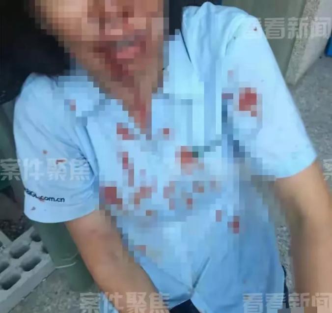 上海，因拆迁款纠纷，外甥带人上门殴打舅舅，冲突中，舅妈拿起身边的腐蚀性溶液泼了过