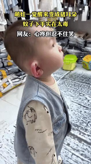 笑喷！娃一觉醒来耳朵肿成猪耳朵，蚊子：这波我直接封神
 
谁能想到，娃睡了一觉，