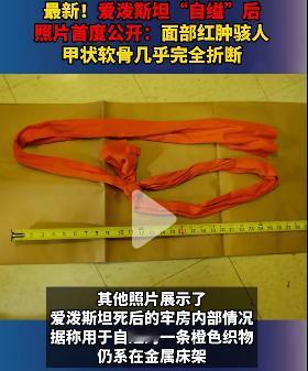 爱泼斯坦真的“自杀”了吗？真的是“自杀”的吗？
其实很多问题都存疑。
以他这种自