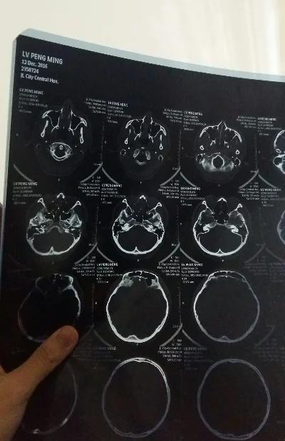 重庆一医生下班后蹲在走廊地上给病人看CT，钥匙串攥手里忘了接女儿，这一蹲比任何广
