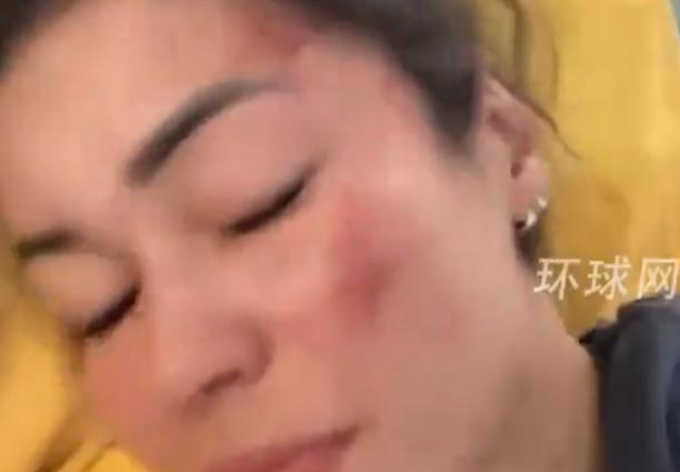 一对西班牙夫妻在印度被7人轮流侵害长达3个小时！

2024年3月1日，两人抵达