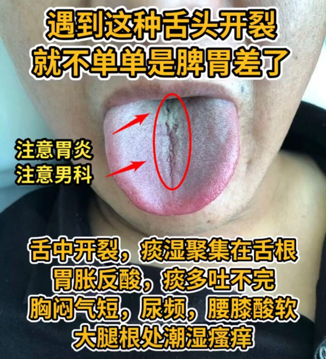 薛老师 舌战分析