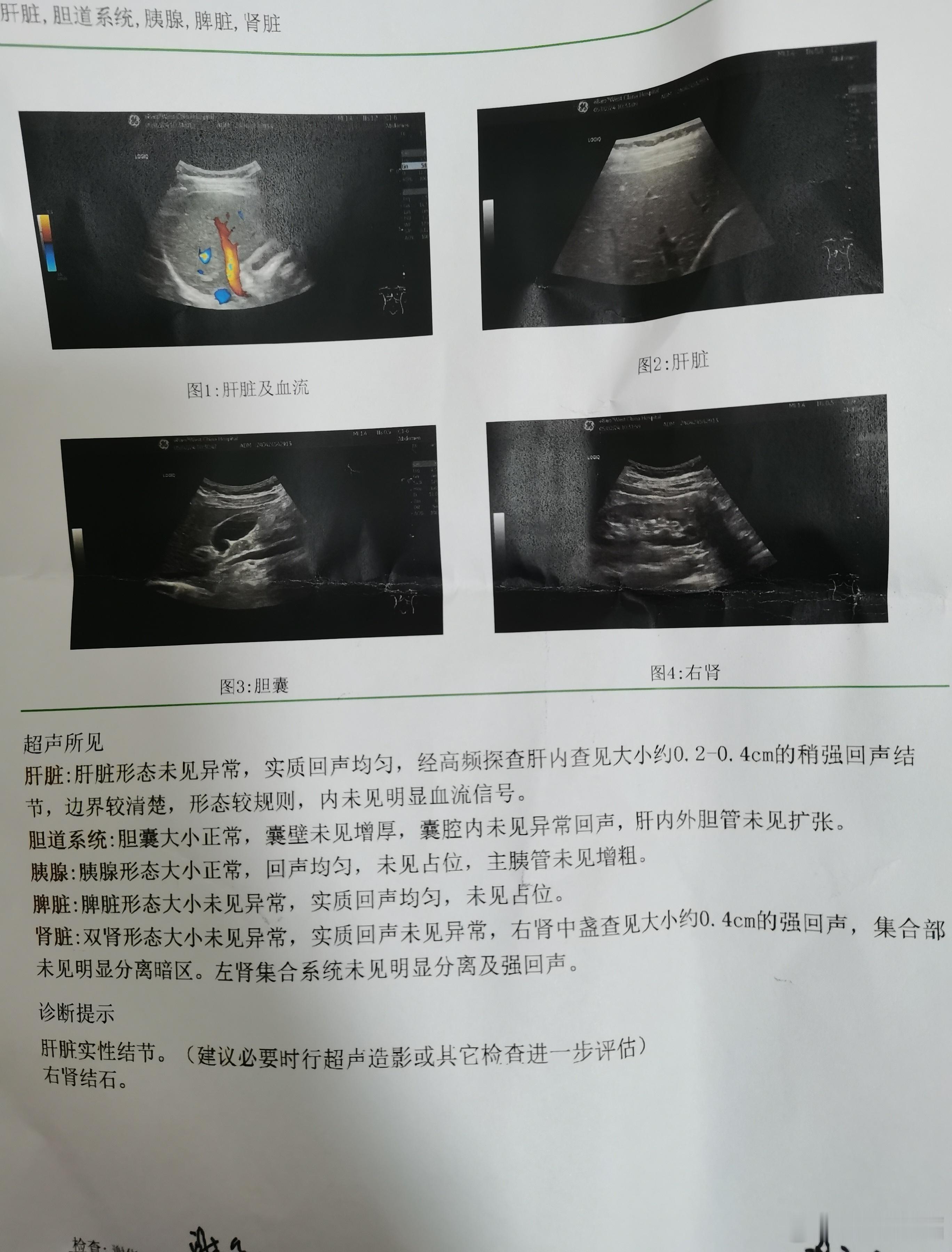 #乙肝[超话]#没有诊断倾向的辅助检查，是对患者来说不够真诚，哪怕你诊断倾向不确