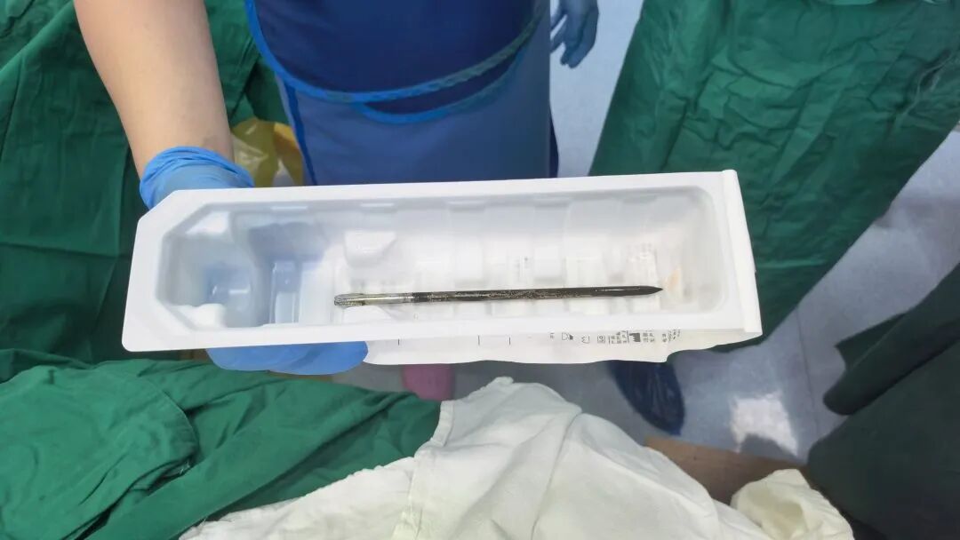 广东一男子被18厘米钢钻从眼球处刺穿头颅，离致命大动脉仅数毫米，命悬一线，医护4小时急救→