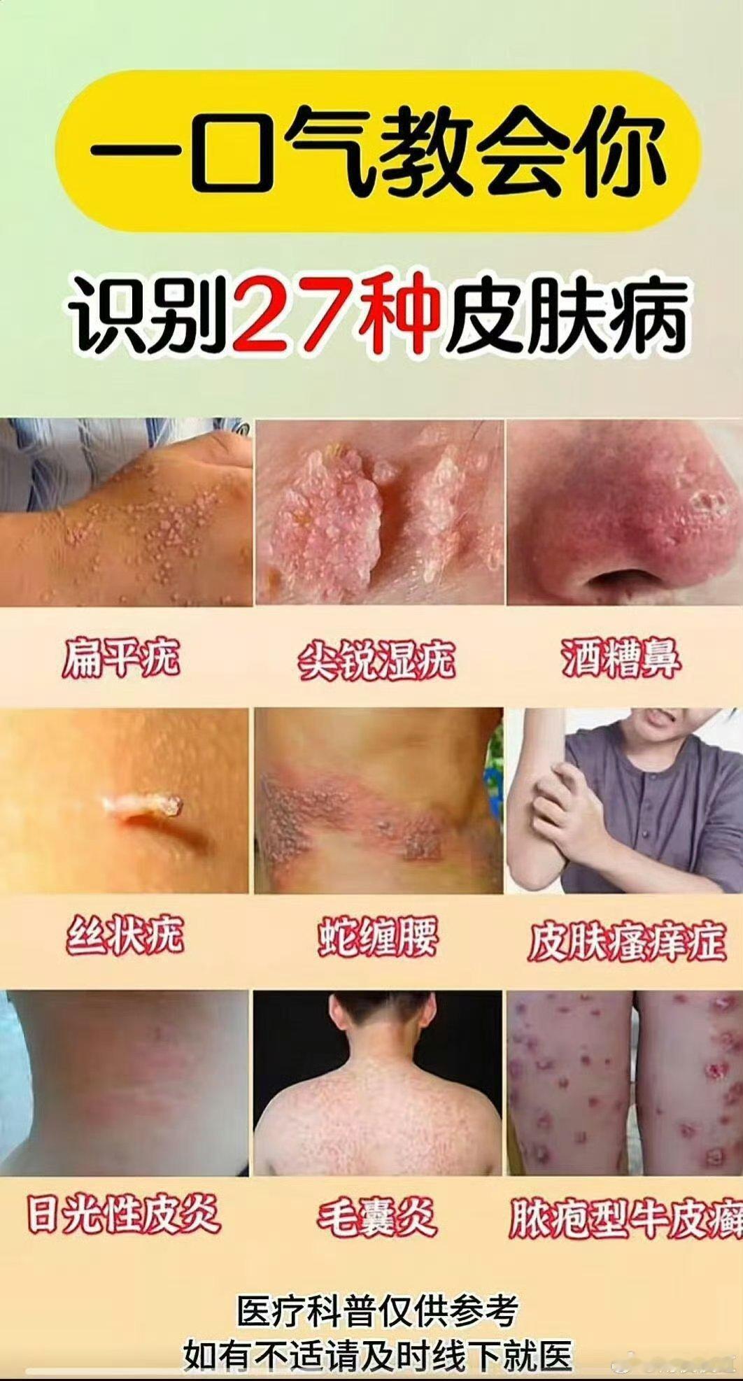 以为没事但很严重的皮肤病 皮肤毛病很烦恼，我们要及时关注自己的皮肤，及时就医皮肤