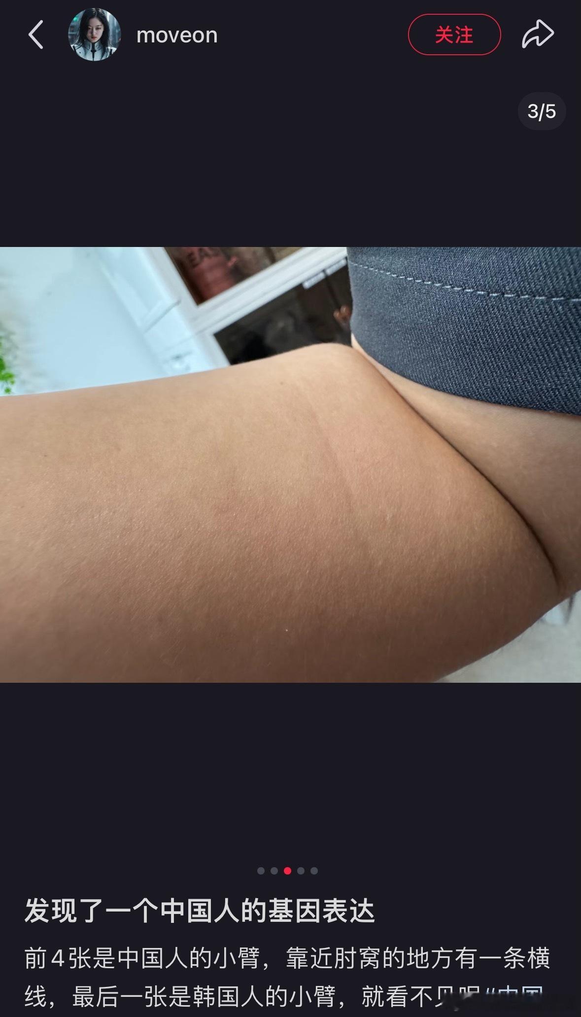 涨知识了！原来胳膊上有“线”是纯种汉族人的标记[傻眼]我看了一下我有哈哈哈哈哈哈