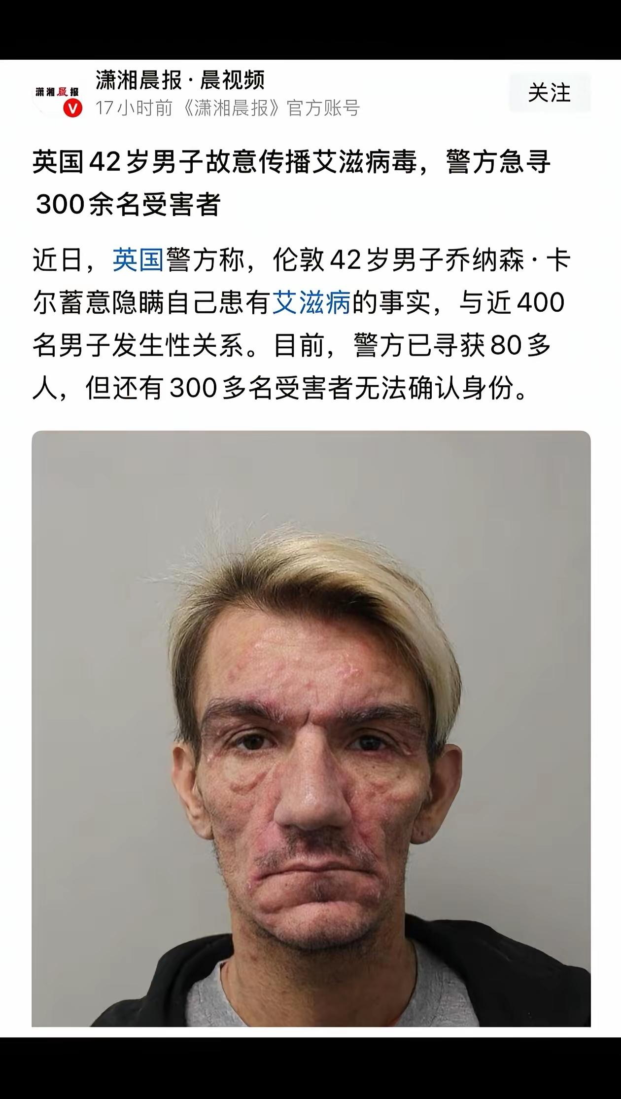 真的不明白，脸都烂成这样了，竟然还能和那么多男生有关系？
这个世界，很多东西确实