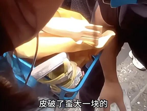 家长别再跟风了！这些“遛娃神器”专坑孩子，已有人受伤
 
你家是不是也买过所谓的