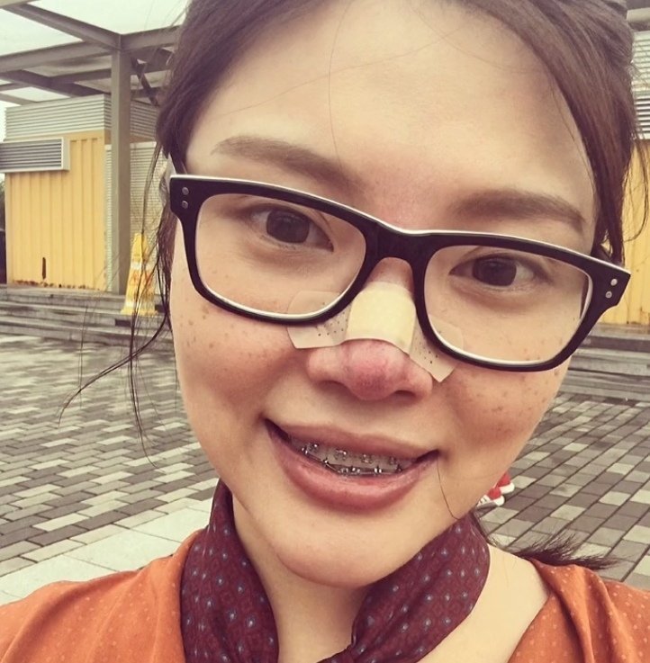 这居然是徐冬冬黑图 以为是邻家学妹的旧照，结果是徐冬冬！雀斑黑框镜太接地气，钢丝