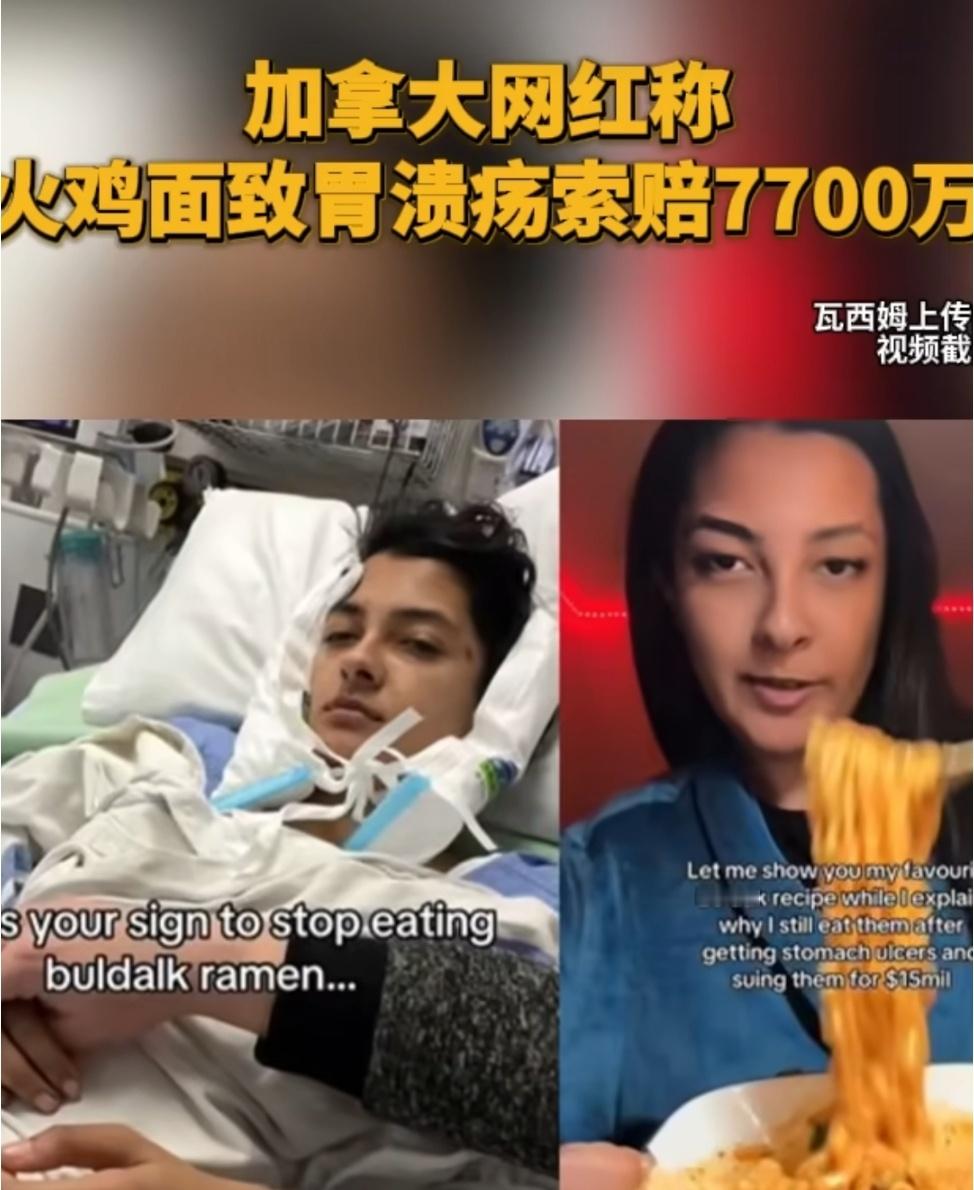 网红称吃火鸡面烧穿胃索赔7700万姐们能长期食用火鸡面导致胃大面积溃疡，这也能起