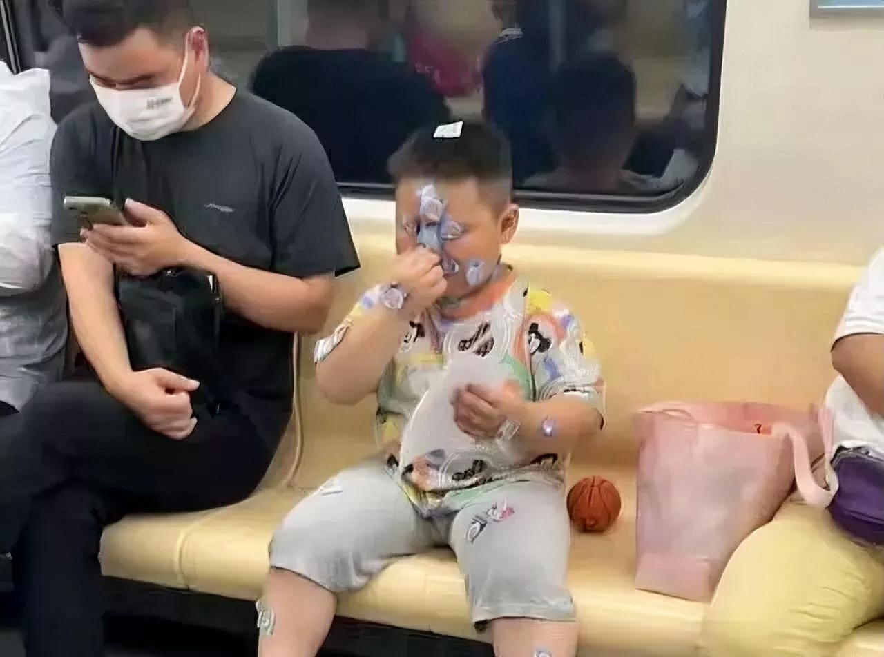 小朋友把自己的眼睛粘住了。成功封印了自己。