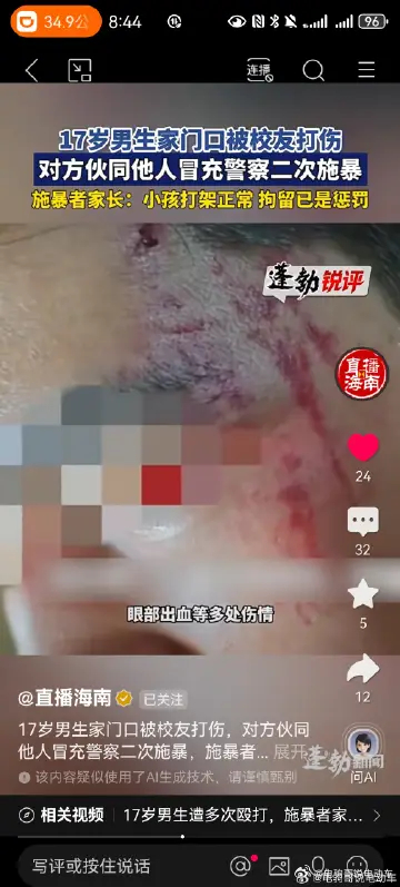 霸凌，加冒充警察，并且是两次殴打，这绝对是刑事案件了吧。严惩霸凌者 17岁男生遭