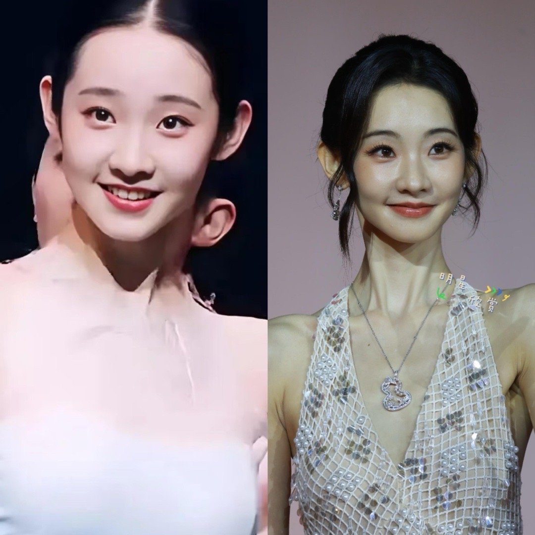 张艺凡瘦到断崖式衰老了，肌肉走向都变了 ​​​