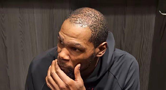 我真的孤陋寡闻了！
一直以为只有亚洲人才会秃顶，
原来全世界都会秃顶啊！
连杜兰