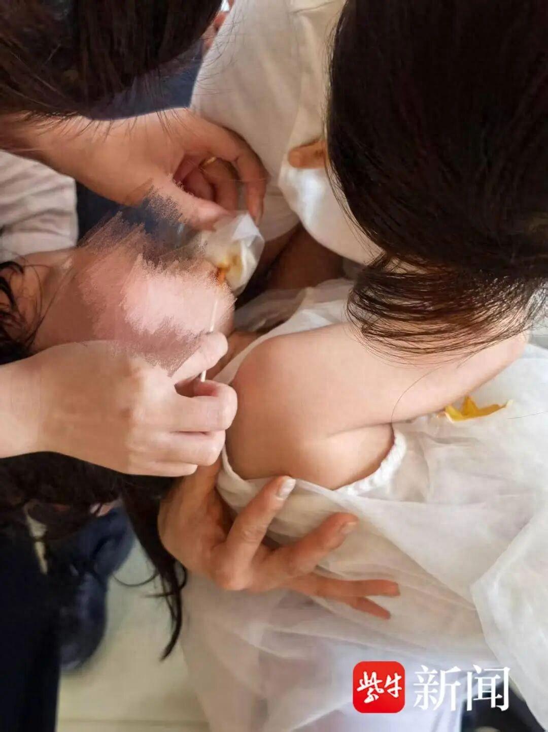 三亚某机场摆渡车车门一开，转身短短几秒，3岁女孩连人带婴儿车摔落地面，脸部缝30