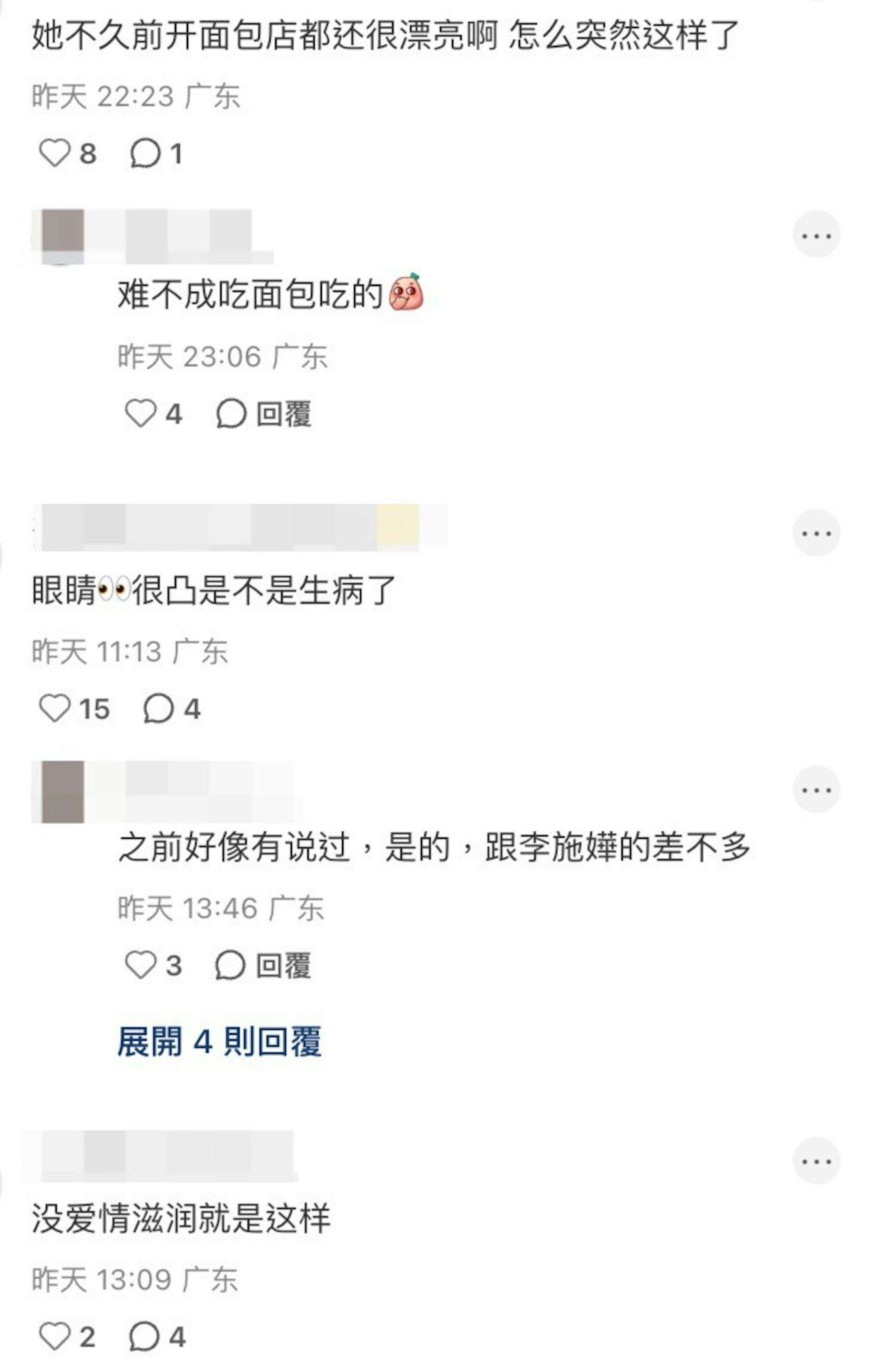 45岁唐诗咏露面状态惹热议面部浮肿松弛现双下巴 眼球突出网民忧心健康现年45岁的