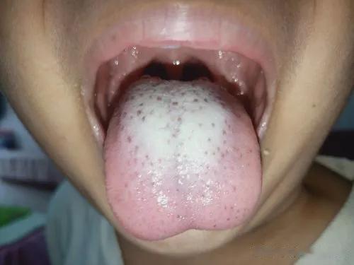 孩子脾胃不好，3个方法照着做就行了
 
如果你家孩子脾胃虚弱，食欲不好，吃得少，