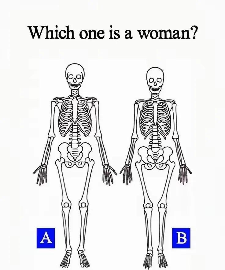 图片上有个副骨骼，请问哪位是女性，哪位是男性？这涉及到人体解剖方面的许多知识。男