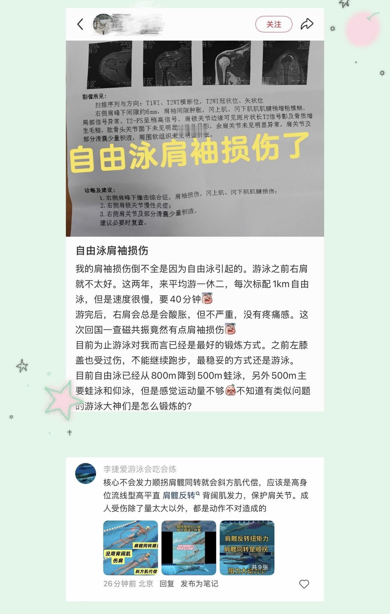 动作不对导致肩损伤