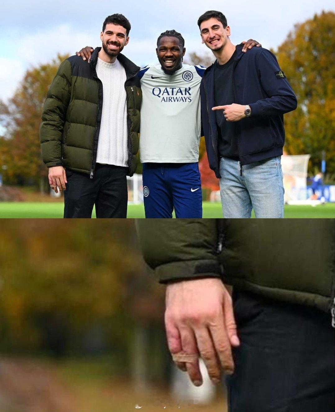 国际排坛动态 拉维亚的手指伤势近照 ​​​