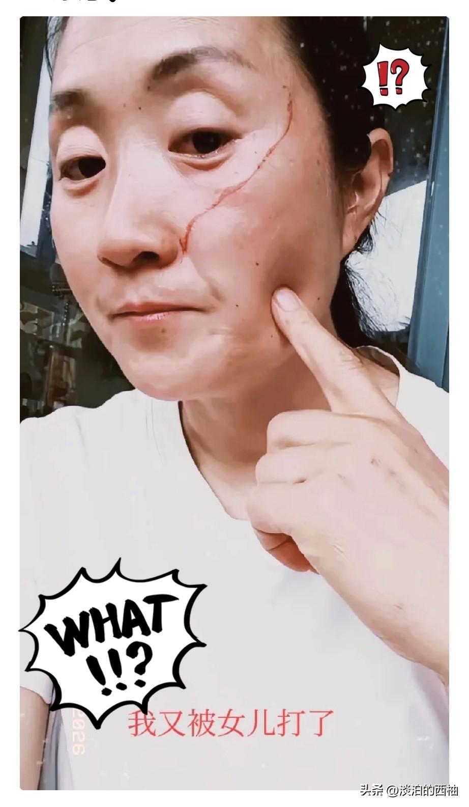 妈妈被高考完的女儿打破脸，原因是她中午做饭吵醒了女儿，女儿先是砸东西，妈妈说了她
