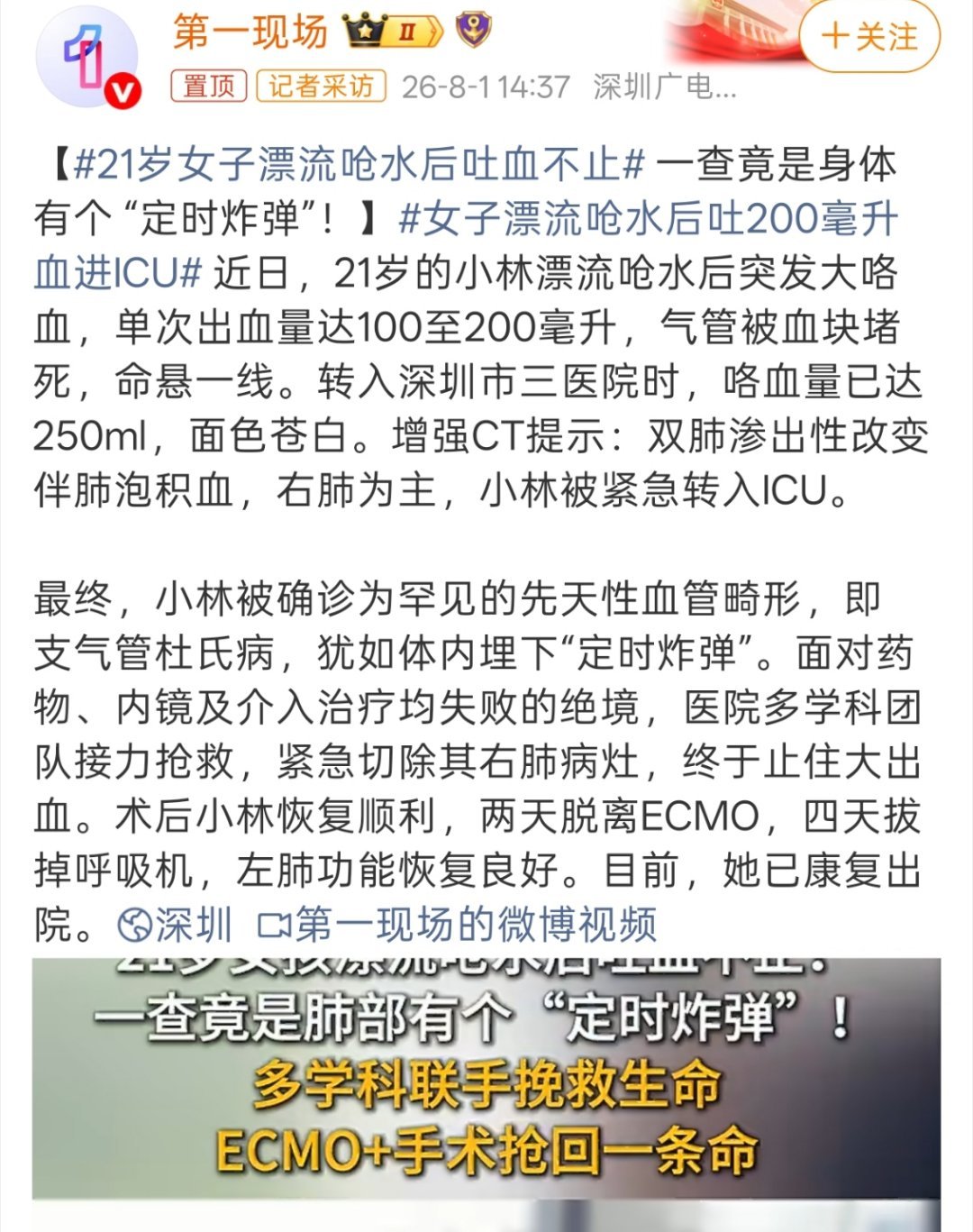 21岁女子漂流呛水后吐血不止也是不幸中的万幸了，这种先天性的血管畸形真的是防不胜