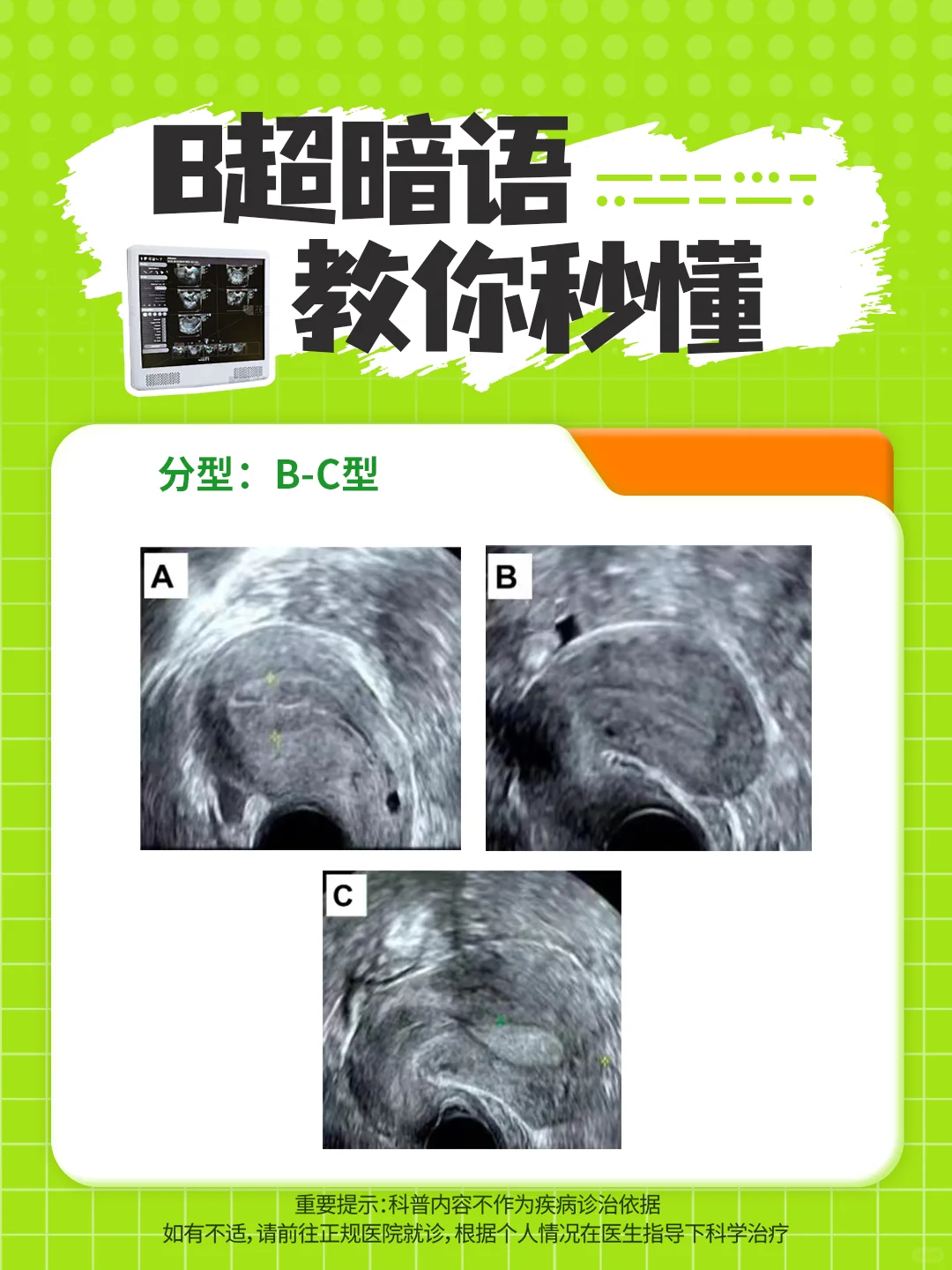 B超暗语，教你秒懂！
