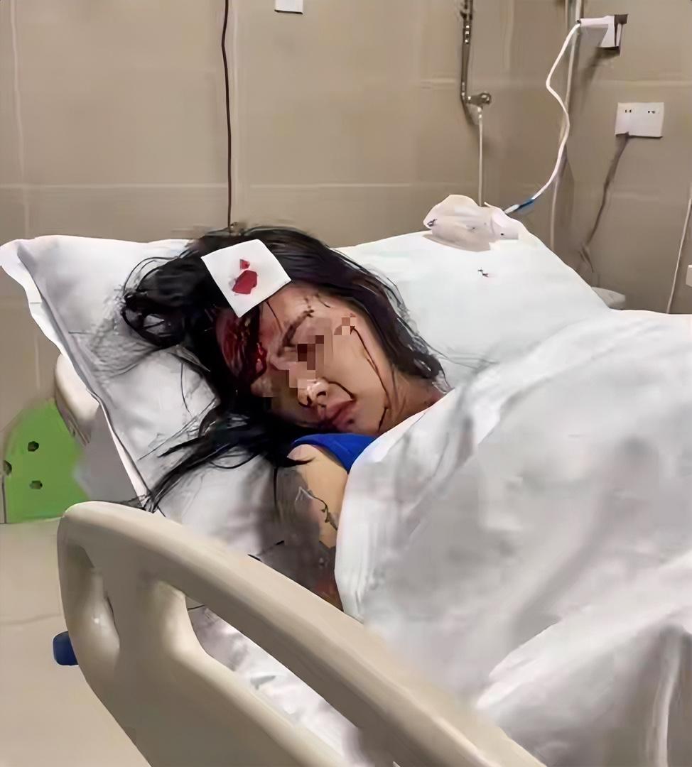 重庆一女子被闺蜜用菜刀砍伤了头部，当场就鲜血直流，最后到医院缝了10针才脱离危险