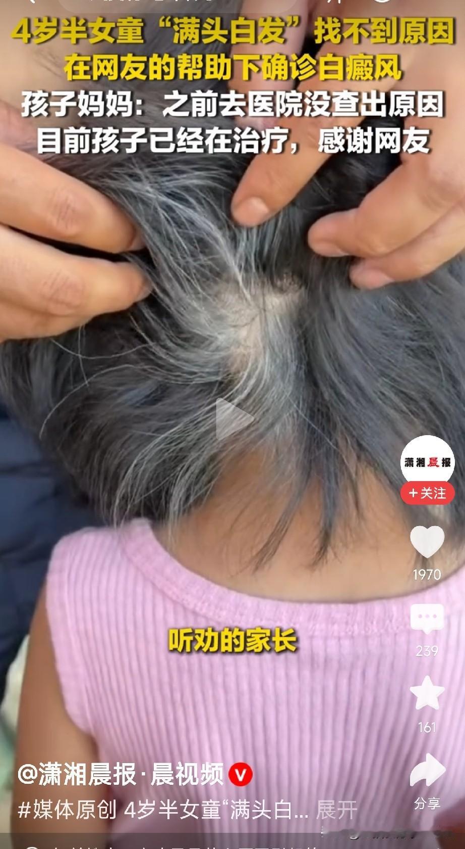 互联网的力量太强大了

贵州毕节的杨女士，看着四岁半的女儿头发一点点变白，心里非