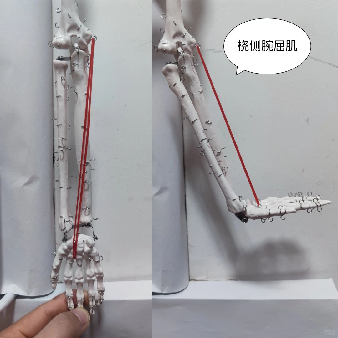 桡侧腕屈肌