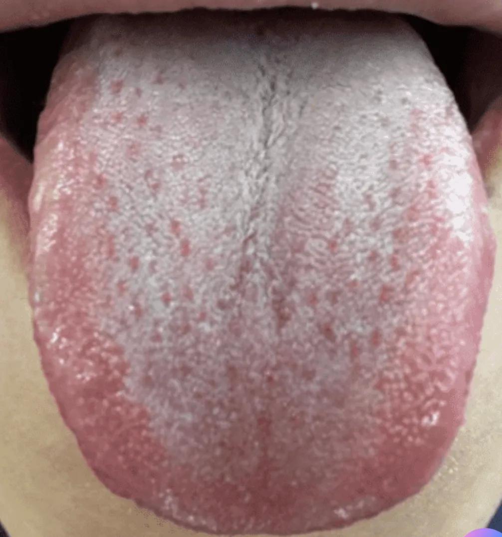 那方面能力差，吃了很多补药没效果，这该怎么办？其实要想补，很简单，找对方法是关键