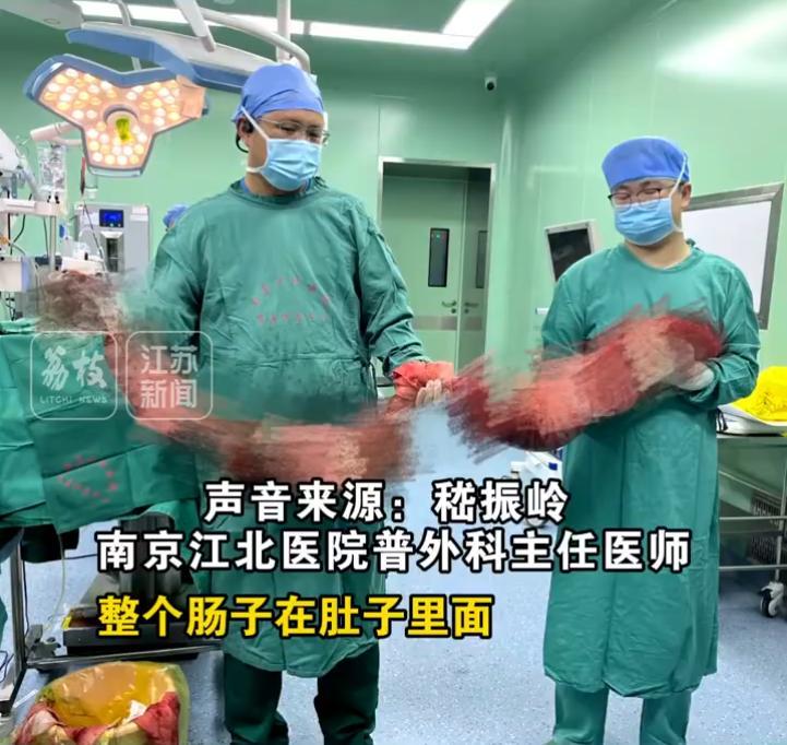 这就是不上厕所的下场！5月22日，南京一40岁男子4个月未排便，医生做手术后从他