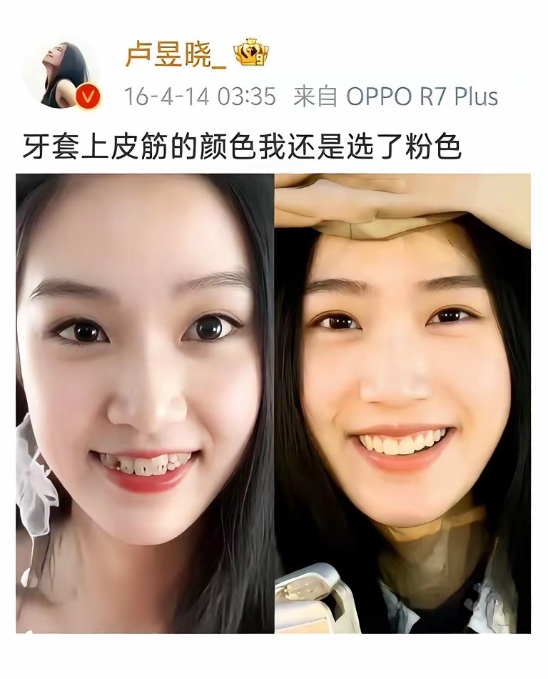 怪不得都说江浙沪独女是“顶配开局”。你看卢昱晓，她爸是上海一家大医院的院长，妈妈