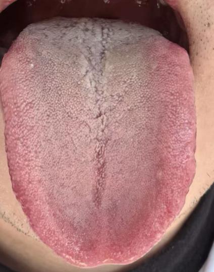 身体状态下滑？多是精血亏虚，影响海绵体健康






有不少朋友问我，为什么最